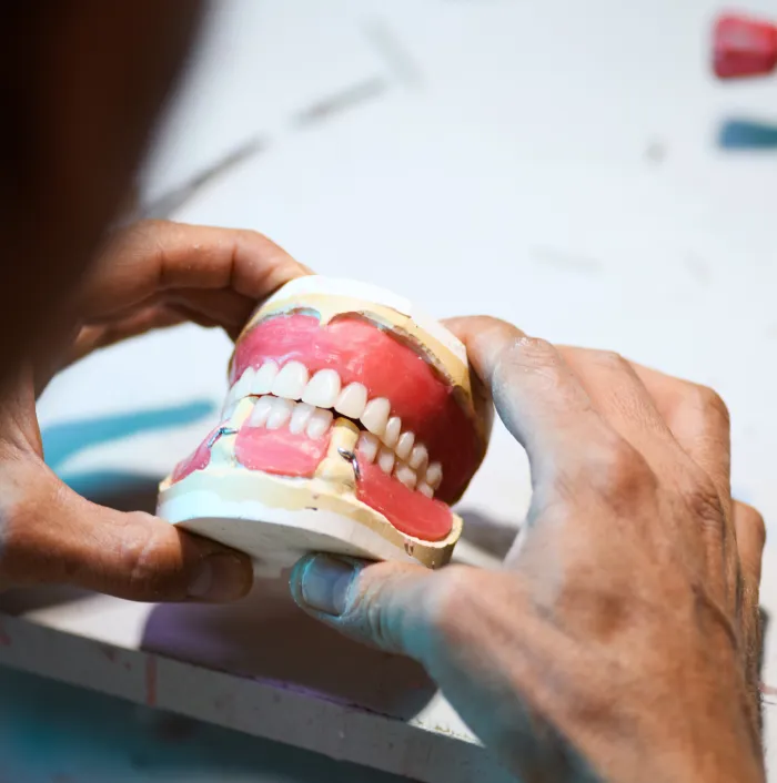 Denture-Design-Dental-Lab