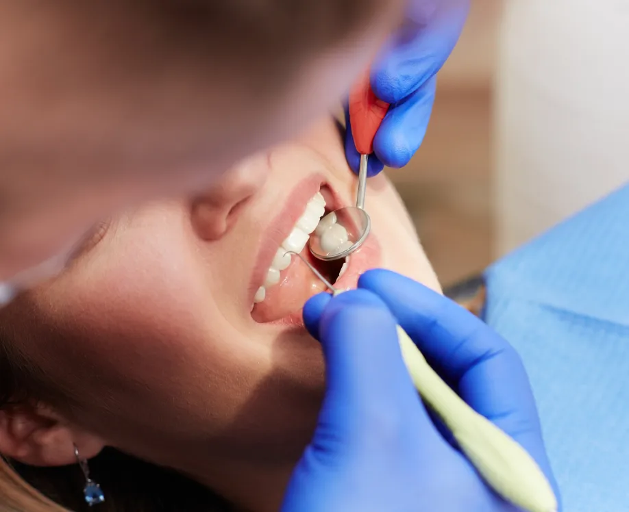 Denture-Design-Complete-Care-with-Dentures-Direct-Approach