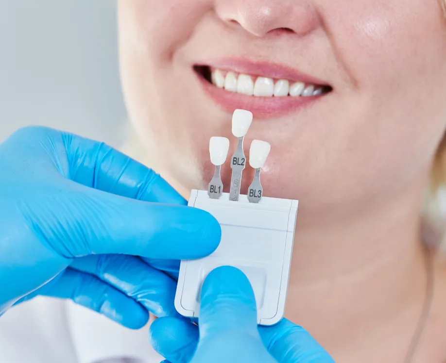 Denture-Design-New-Smile-Denture-Design