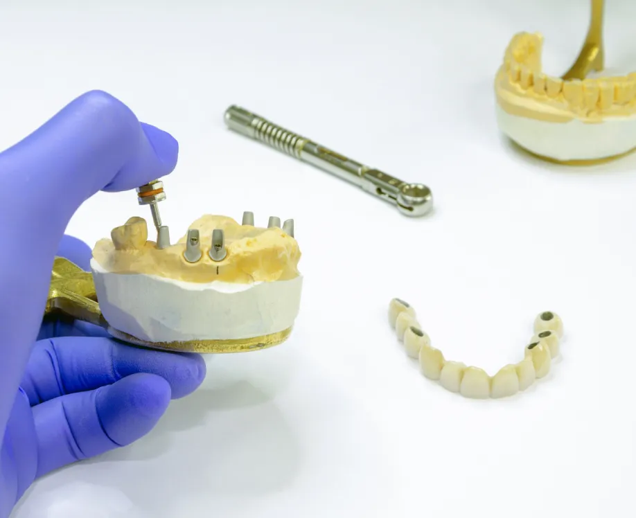 Denture-Design-Why-Are-We-Located-In-Franklin-Idaho