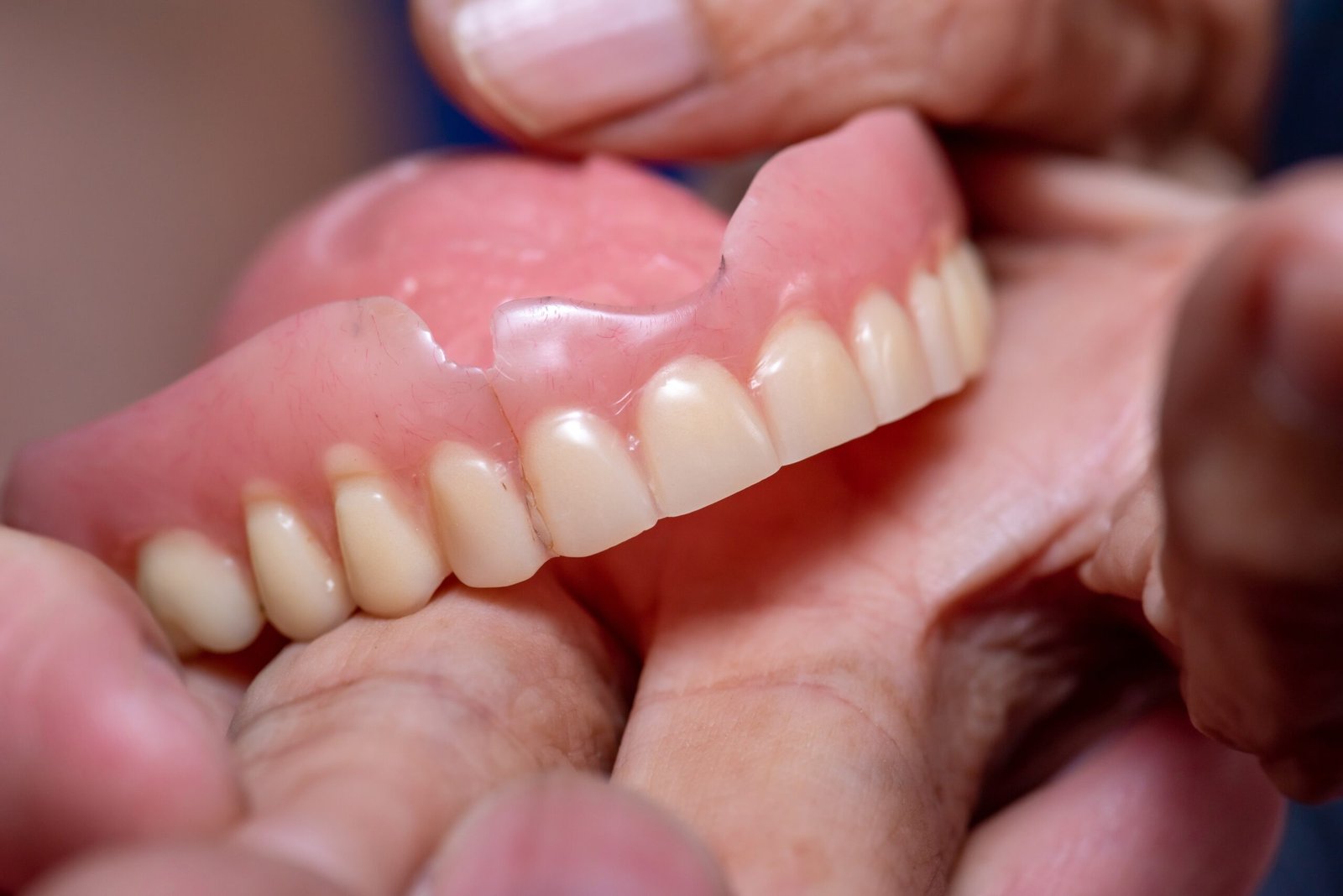 Denture-Design-Malad-2 Up Close Denture