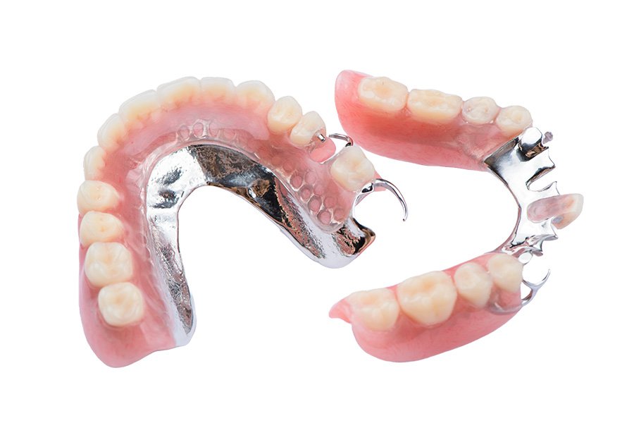 partial-metal-dentures Denture-Design-Expert-Local-Denturist-Services-for-Logan